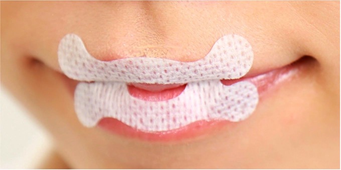 Mouthtape oxchinno 01
